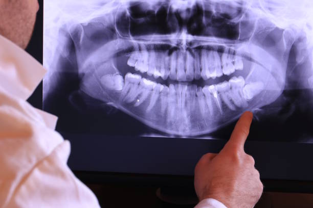 Best Emergency Gum Treatment in Rushvle, IL