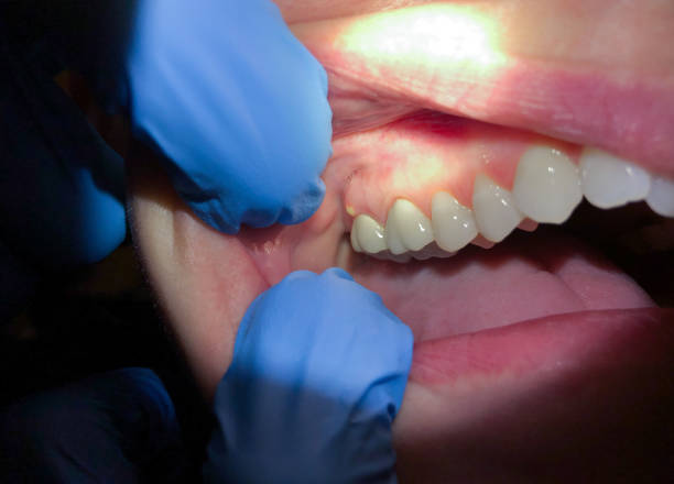 Best 24-Hour Emergency Dentist in Rushvle, IL