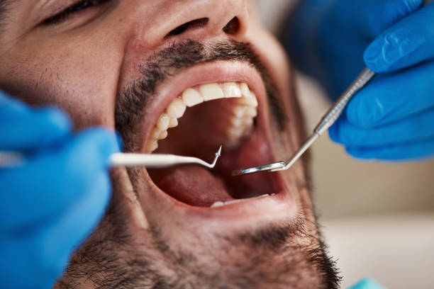 Best After-Hours Dental Trauma Care in Rushvle, IL