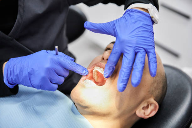 Best Emergency Treatment for Dental Infections or Abscesses in Rushvle, IL